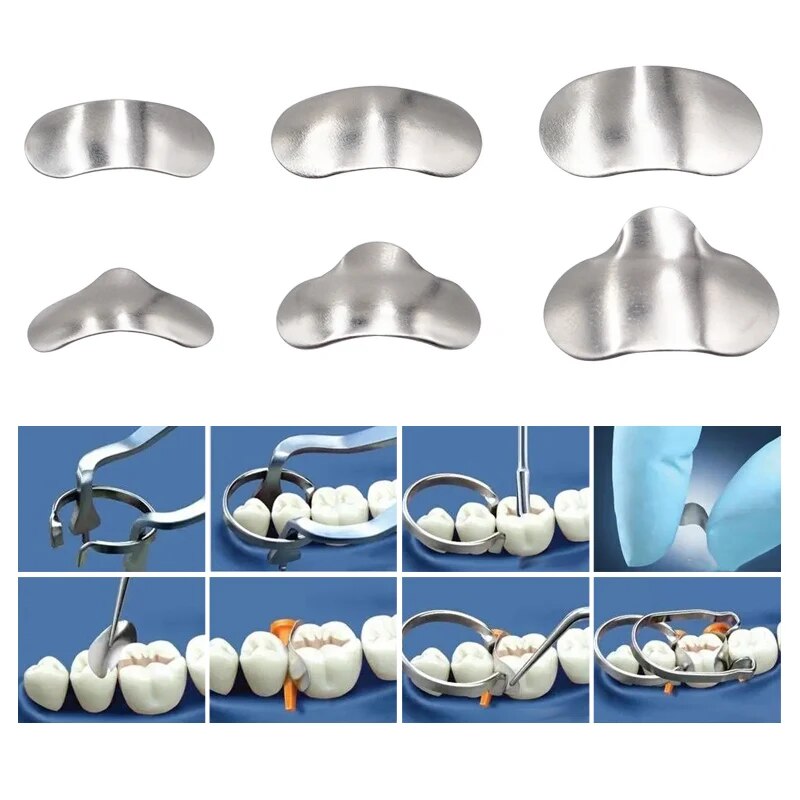 100Pcs/Box Dental Sectional Ma - Resin Art Case review and price